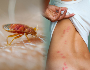 Bed bugs feeding on human blood